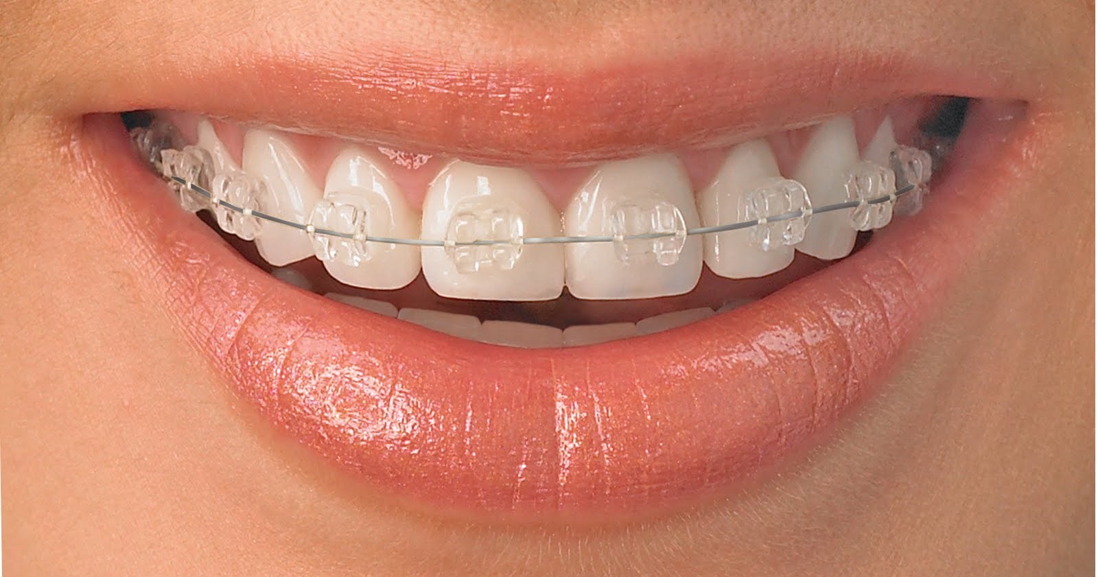 Ortodoncia-Odontologia-Prepagas